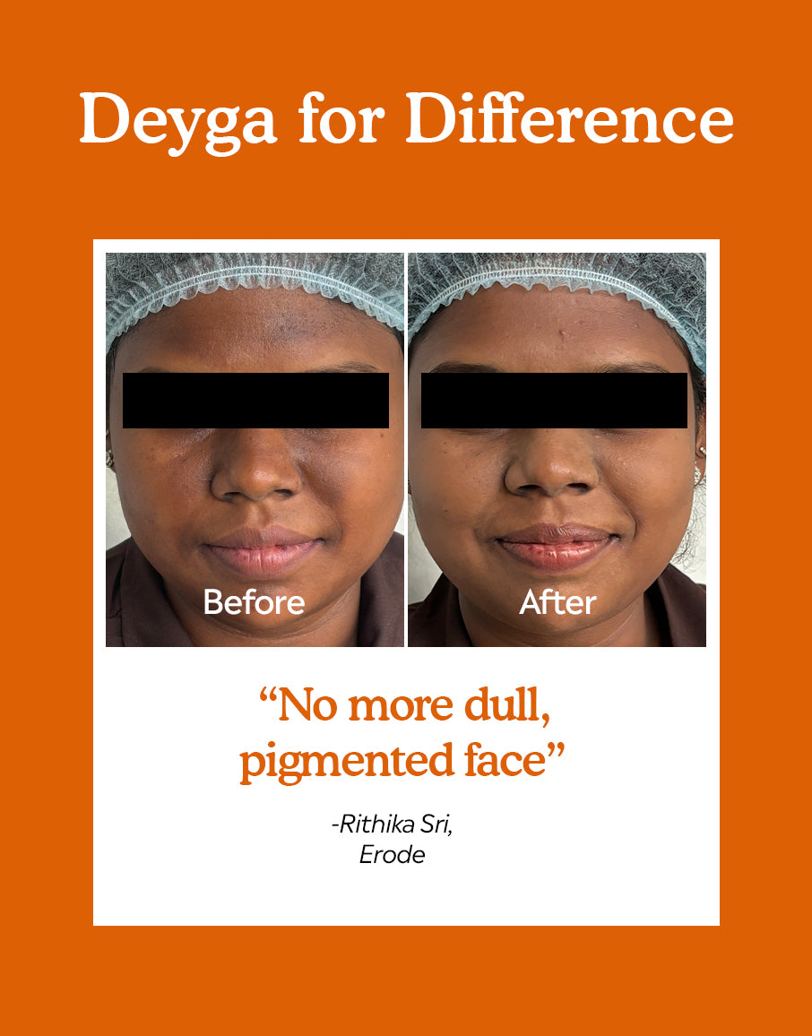 10% Vitamin C Face Serum